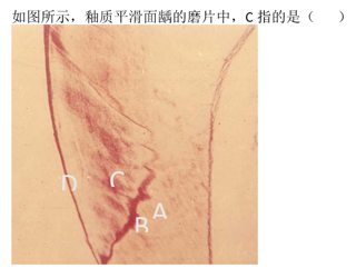 智慧树知到《牙体牙髓病学》章节测试答案