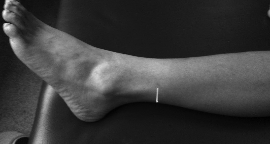 智慧树知到《经络畅通病无踪》章节测试答案